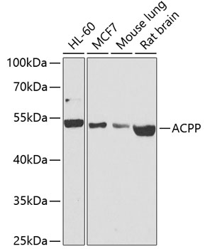 ACPP Polyclonal Antibody (50 µl)