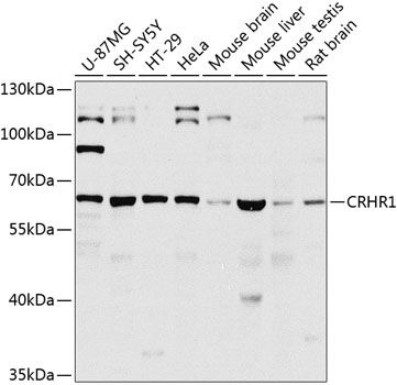 CRHR1 Polyclonal Antibody (50 µl)