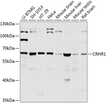 CRHR1 Polyclonal Antibody (100 µl)