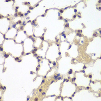 Estrogen Receptor beta Polyclonal Antibody (50 µl)