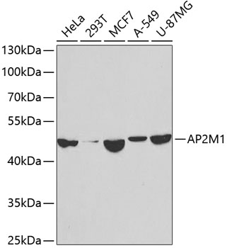 AP2M1 Polyclonal Antibody (100 µl)