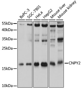 CNPY2 Polyclonal Antibody (100 µl)