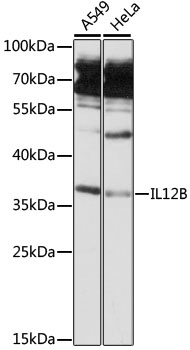 IL12B Polyclonal Antibody (100 µl)