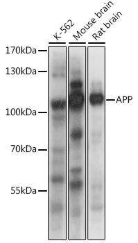 APP Polyclonal Antibody (50 µl)