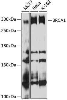 BRCA1 Polyclonal Antibody (100 µl)