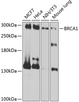 BRCA1 Polyclonal Antibody (100 µl)