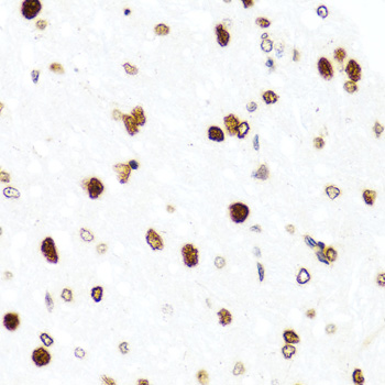 Histone H2AX Polyclonal Antibody | EpigenTek Histone H2AX Polyclonal Antibody | EpigenTek