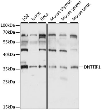 DNTTIP1 Polyclonal Antibody (50 µl)