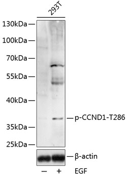 Phospho-CCND1-T286 Polyclonal Antibody (50 µl)