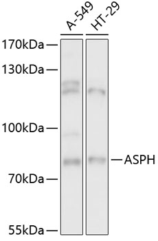 ASPH Polyclonal Antibody (50 µl)