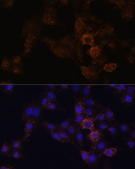 GRP Polyclonal Antibody (50 µl)