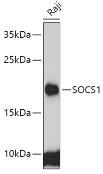 SOCS1 Polyclonal Antibody