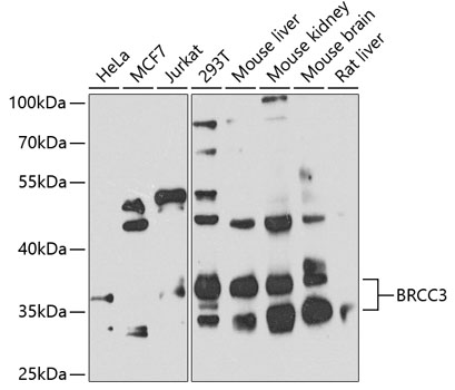 BRCC3 Polyclonal Antibody (50 µl)