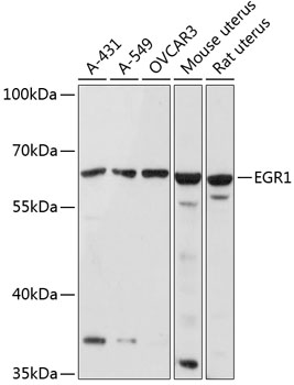 EGR1 Polyclonal Antibody (50 µl)