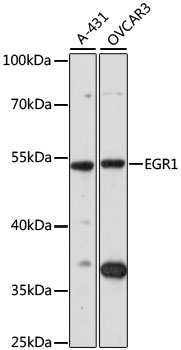 EGR1 Polyclonal Antibody (100 µl)