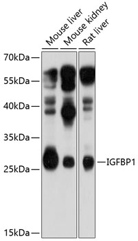 IGFBP1 Polyclonal Antibody (50 µl)