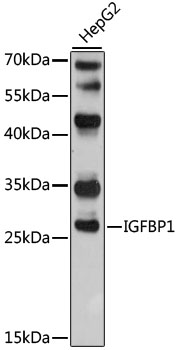 IGFBP1 Polyclonal Antibody (100 µl)