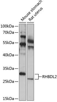 RHBDL2 Polyclonal Antibody