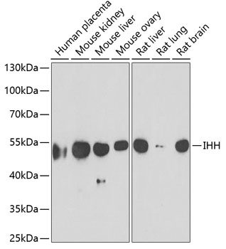 IHH Polyclonal Antibody (100 µl)