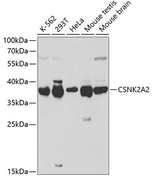CSNK2A2 Polyclonal Antibody (100 µl)