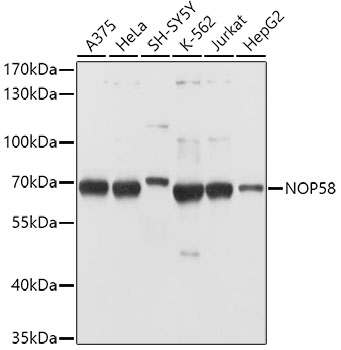 NOP58 Polyclonal Antibody (50 µl)