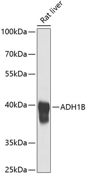 ADH1B Polyclonal Antibody (100 µl)