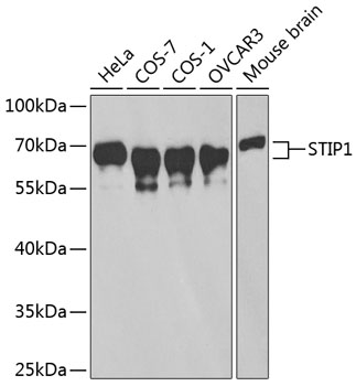 STIP1 Polyclonal Antibody
