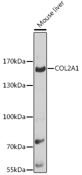 COL2A1 Polyclonal Antibody