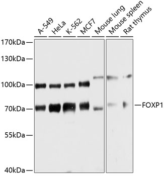 FOXP1 Polyclonal Antibody (100 µl)