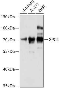 GPC4 Polyclonal Antibody (100 µl)