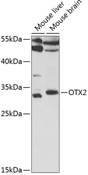 OTX2 Polyclonal Antibody