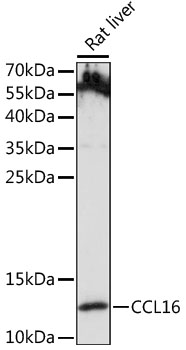 CCL16 Polyclonal Antibody (100 µl)