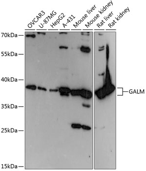 GALM Polyclonal Antibody (100 µl)