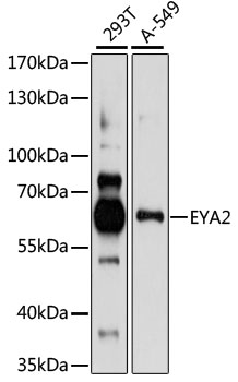 EYA2 Polyclonal Antibody (100 µl)