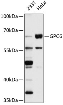 GPC6 Polyclonal Antibody (100 µl)