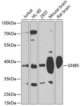 GNB5 Polyclonal Antibody (50 µl)