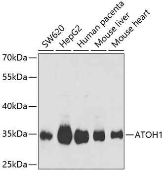 ATOH1 Polyclonal Antibody (100 µl)
