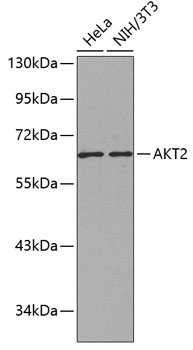 AKT2 Polyclonal Antibody (50 µl)