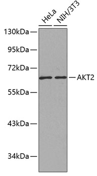 AKT2 Polyclonal Antibody (100 µl)