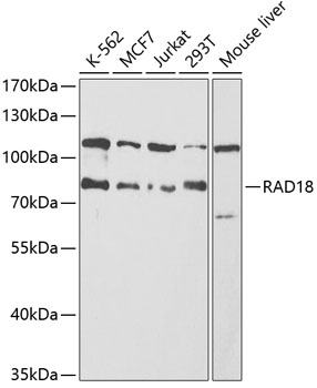 RAD18 Polyclonal Antibody (100 µl)