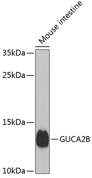 GUCA2B Polyclonal Antibody (50 µl)