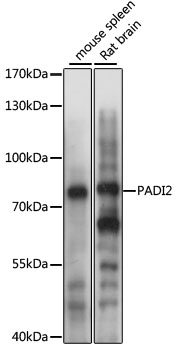 PADI2 Polyclonal Antibody (50 µl)