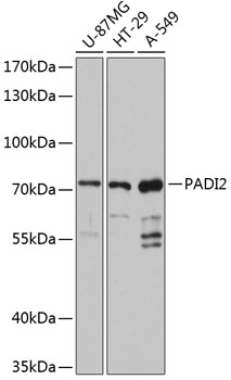 PADI2 Polyclonal Antibody (50 µl)