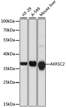 AKR1C2 Polyclonal Antibody (50 µl)