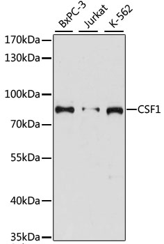 CSF1 Polyclonal Antibody (100 µl)