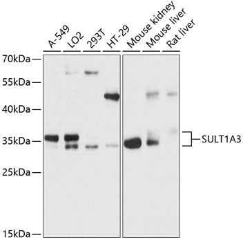 SULT1A3 Polyclonal Antibody