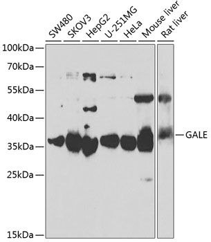 GALE Polyclonal Antibody (50 µl)