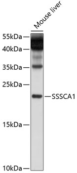 SSSCA1 Polyclonal Antibody (50 µl)