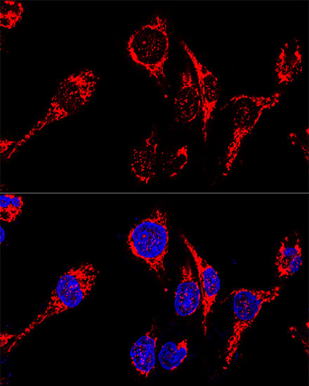 AIF Polyclonal Antibody (100 µl)