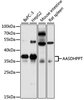AASDHPPT Polyclonal Antibody (100 µl)